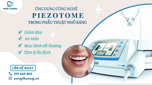 Ứng dụng công nghệ Piezotome trong phẫu thuật nhổ răng